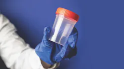 Gloved hand holding urine sample cap for marijuana testing