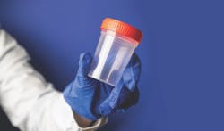 Gloved hand holding urine sample cap for marijuana testing Gloved hand holding urine sample cap for marijuana testing